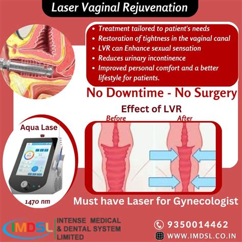 Laser Vaginal Rejuvenation – the Thermigen, Inc. FDA Letter.